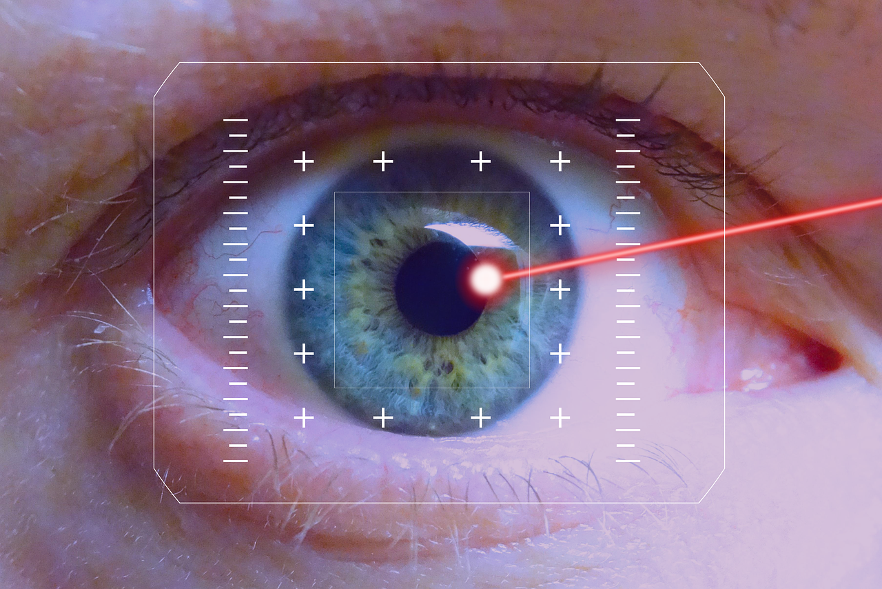 laser eye surgery
